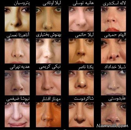 بینی های عملی زنان ایرونی !!!!!!     کدوم بهتر شده؟؟