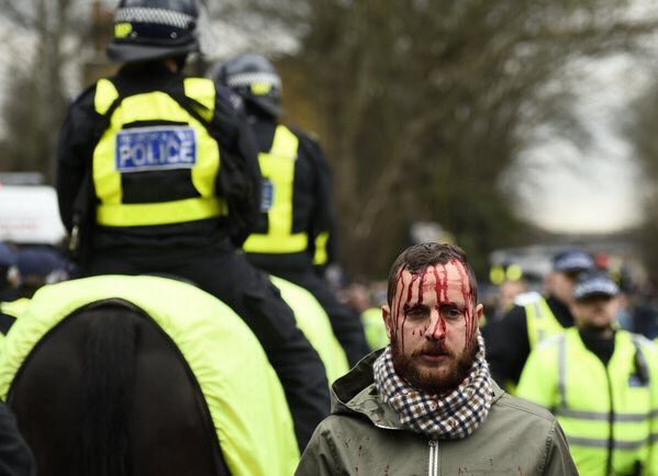 درگیری خونین هواداران در بیرون از ورزشگاه تاتنهام (عکس)