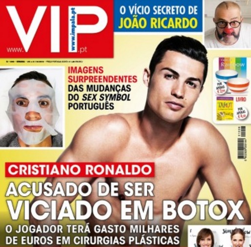ادعای روزنامه پرتغالی؛ رونالدو به بوتاکس معتاد است
