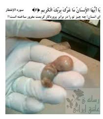 واقعا چ چیزیی؟