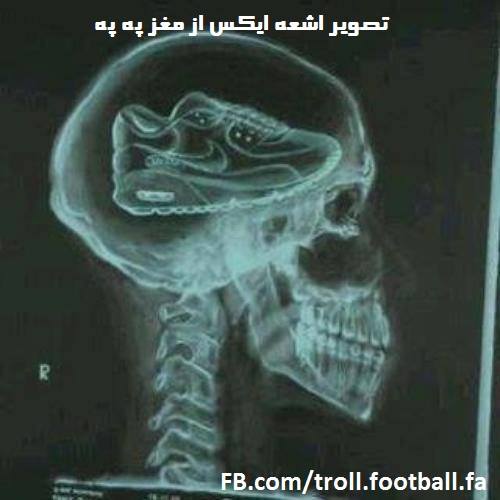من سکوت می کنم